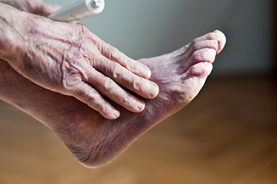 Causes of Poor Foot Circulation and Finding Relief
