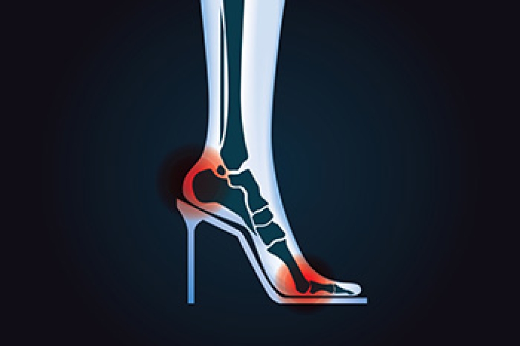 Tips for Seniors Wearing High Heels