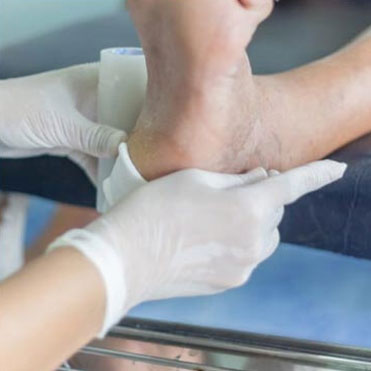 Diabetics Foot Care in the Davidson County, TN: Nashville (Belle Meade, Forest Hills, Berry Hill, Oak Hill, Forest Hills, Goodlettsville) and Sumner County, TN: Hendersonville areas