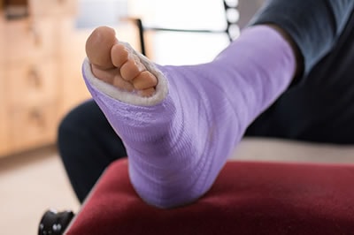 Foot and ankle fractures treatment in the Davidson County, TN: Nashville (Belle Meade, Forest Hills, Berry Hill, Oak Hill, Forest Hills, Goodlettsville) and Sumner County, TN: Hendersonville areas