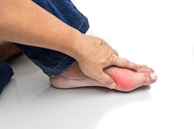 Understanding What Causes Gout