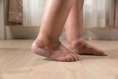 Causes of Swollen Feet and When to Seek Help